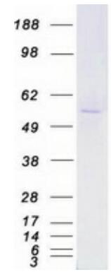 Coomassie blue staining of purified YES1 protein.